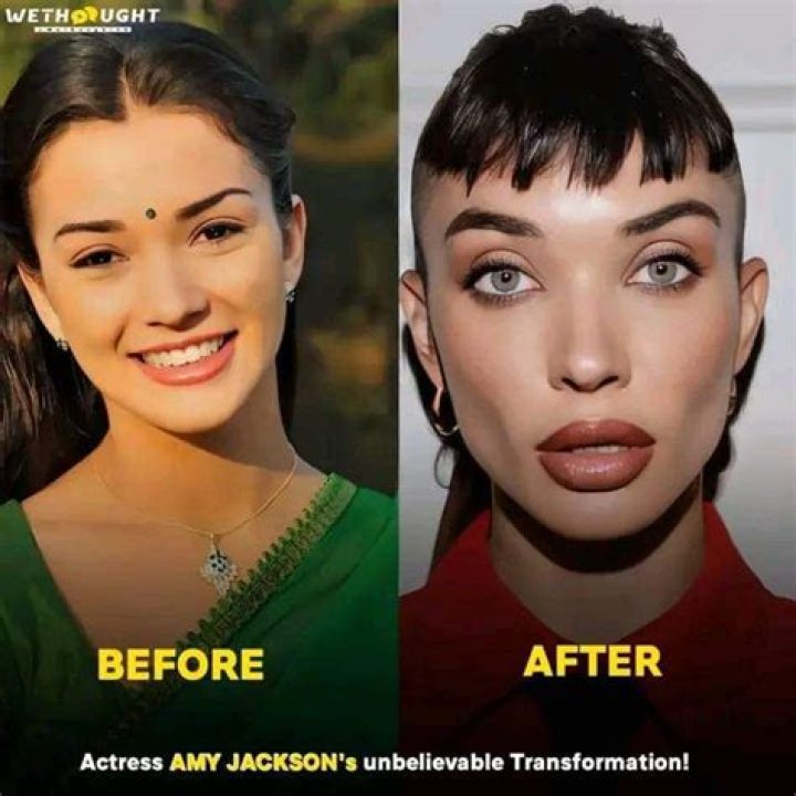 Amy Jackson Plastic Surgery