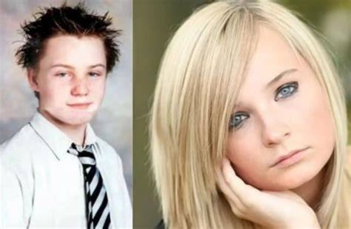 Kim Petras Plastic Surgery: